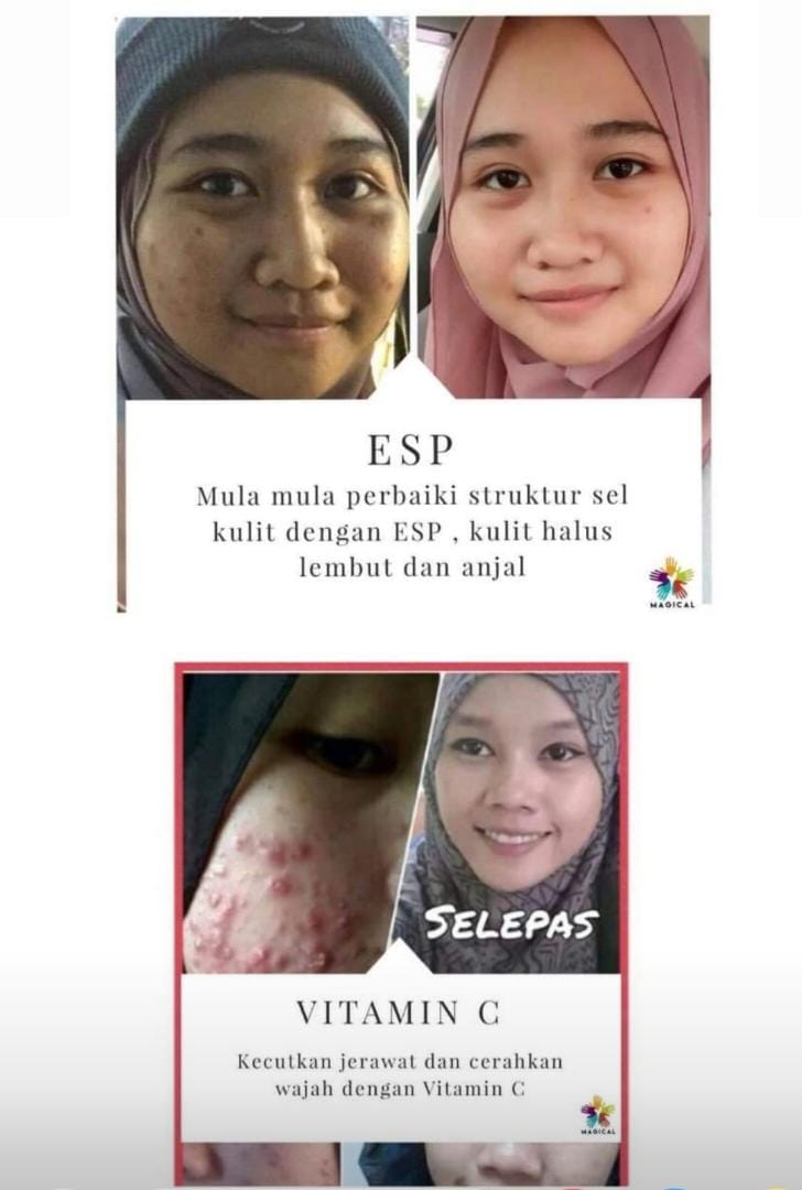 SET CANTIK SHAKLEE