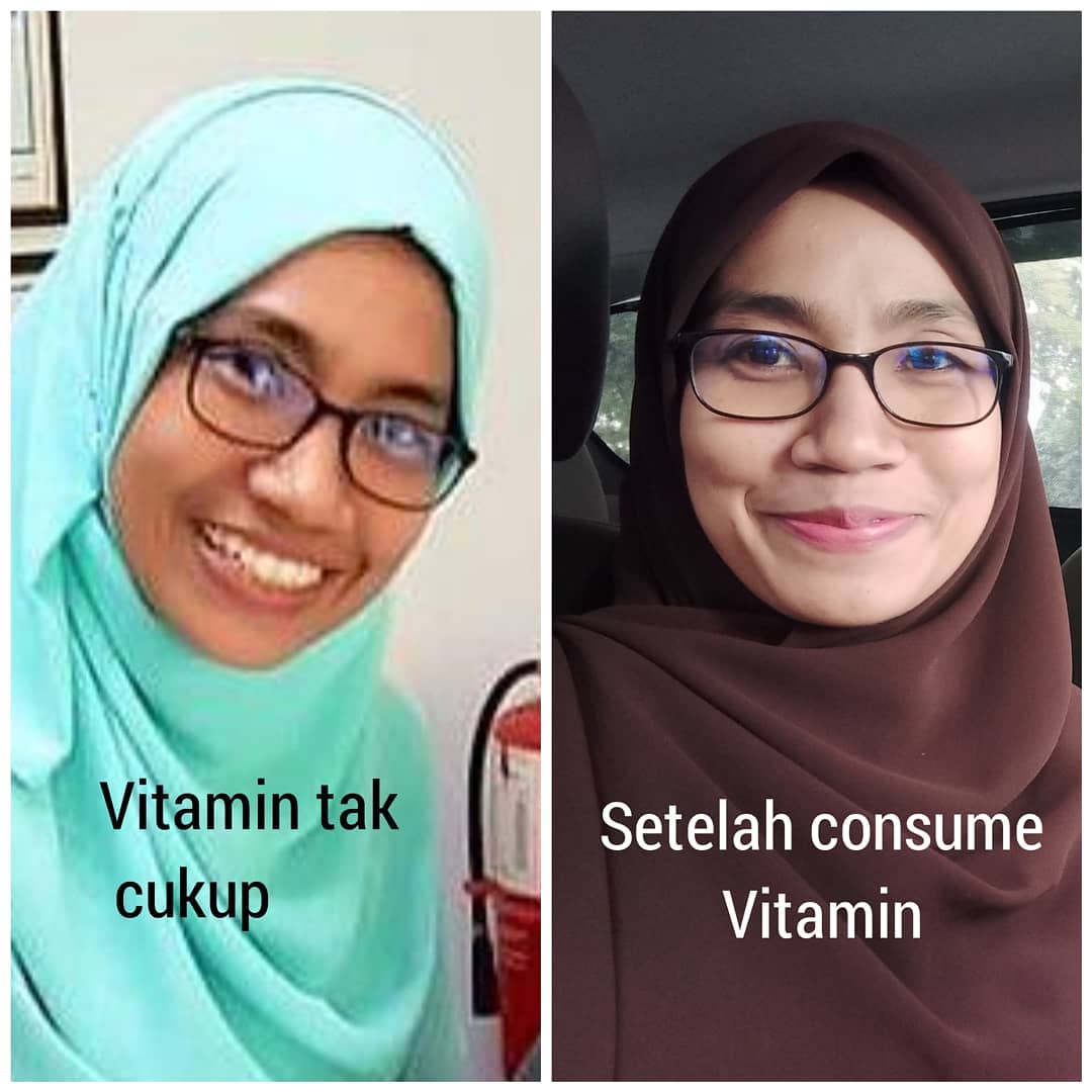 Testimoni Vitamin C Shaklee
