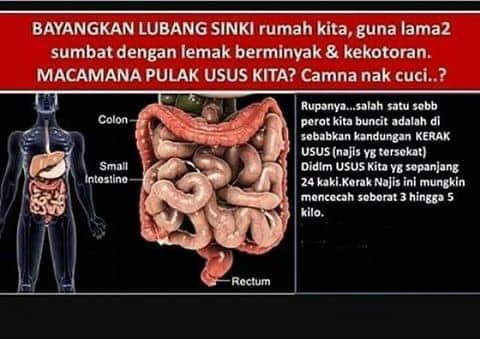 Usus kotor kerana sembelit