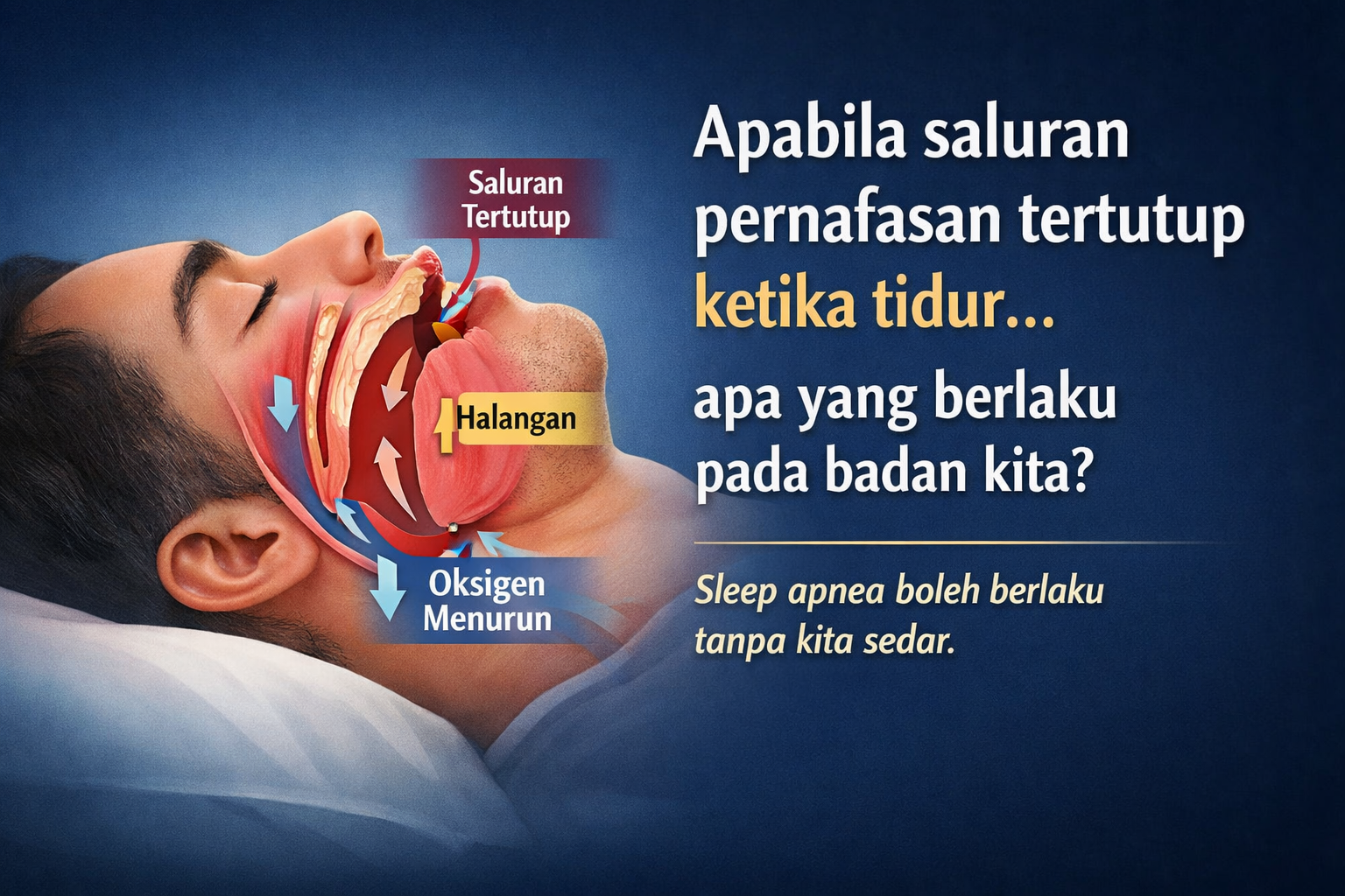 SLEEP APNEA